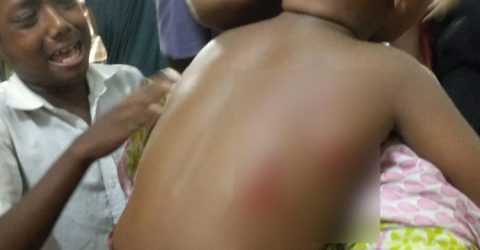 বগুড়ায় কুকুরের কামড়ে আহত ২৩