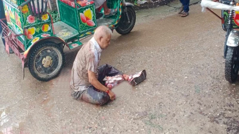 নাটোর জেলা বিএনপির আহ্বায়ক বাচ্চুকে ঢাকায় স্থানান্তর