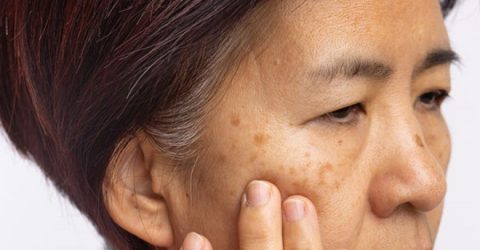 মেছতা সম্পর্কে যা কিছু জানা জরুরি