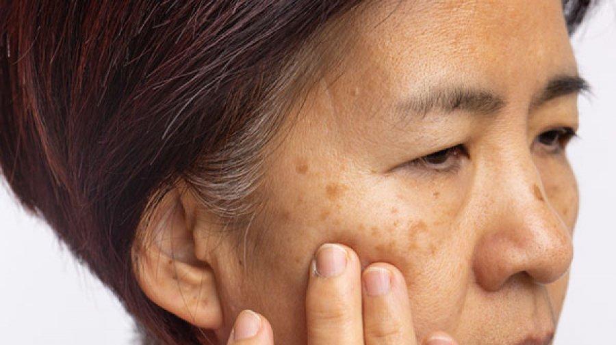 মেছতা সম্পর্কে যা কিছু জানা জরুরি