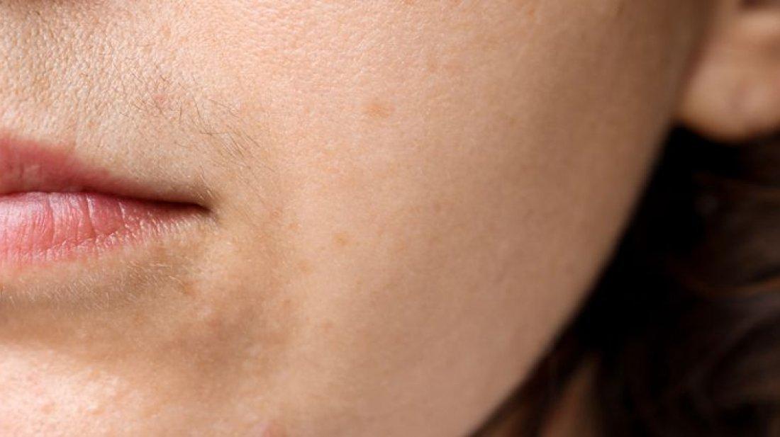 ঘরেই উঠিয়ে ফেলুন অবাঞ্ছিত লোম