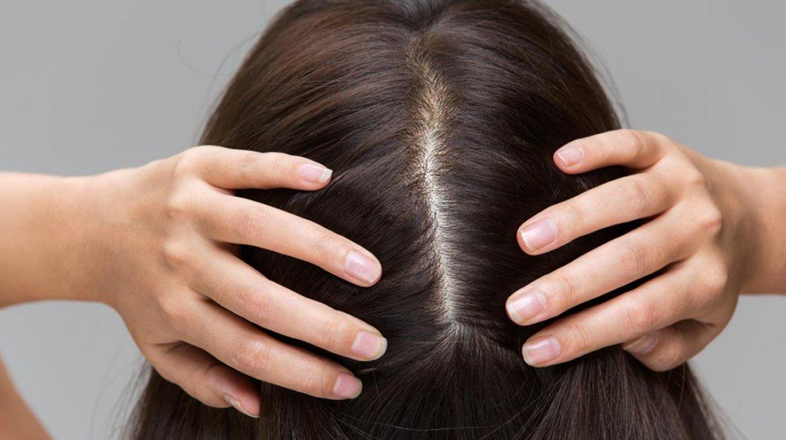 এই ৫ কারণে চুলে গ্লিসারিন ব্যবহার করা জরুরি