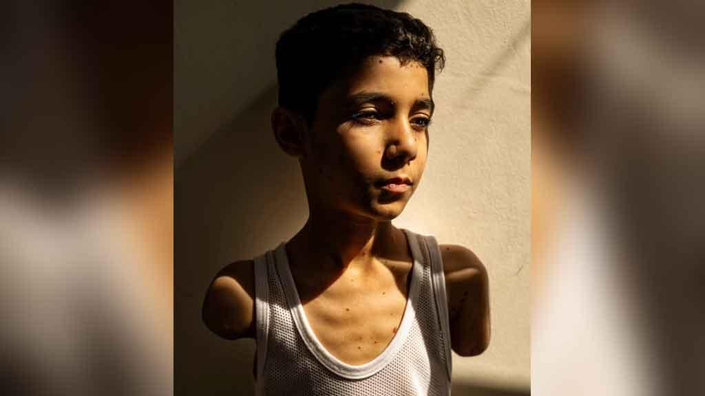 যুদ্ধাহত ফিলিস্তিনি শিশুর ছবি জিতল ‘প্রেস ফটো অব দ্য ইয়ার’