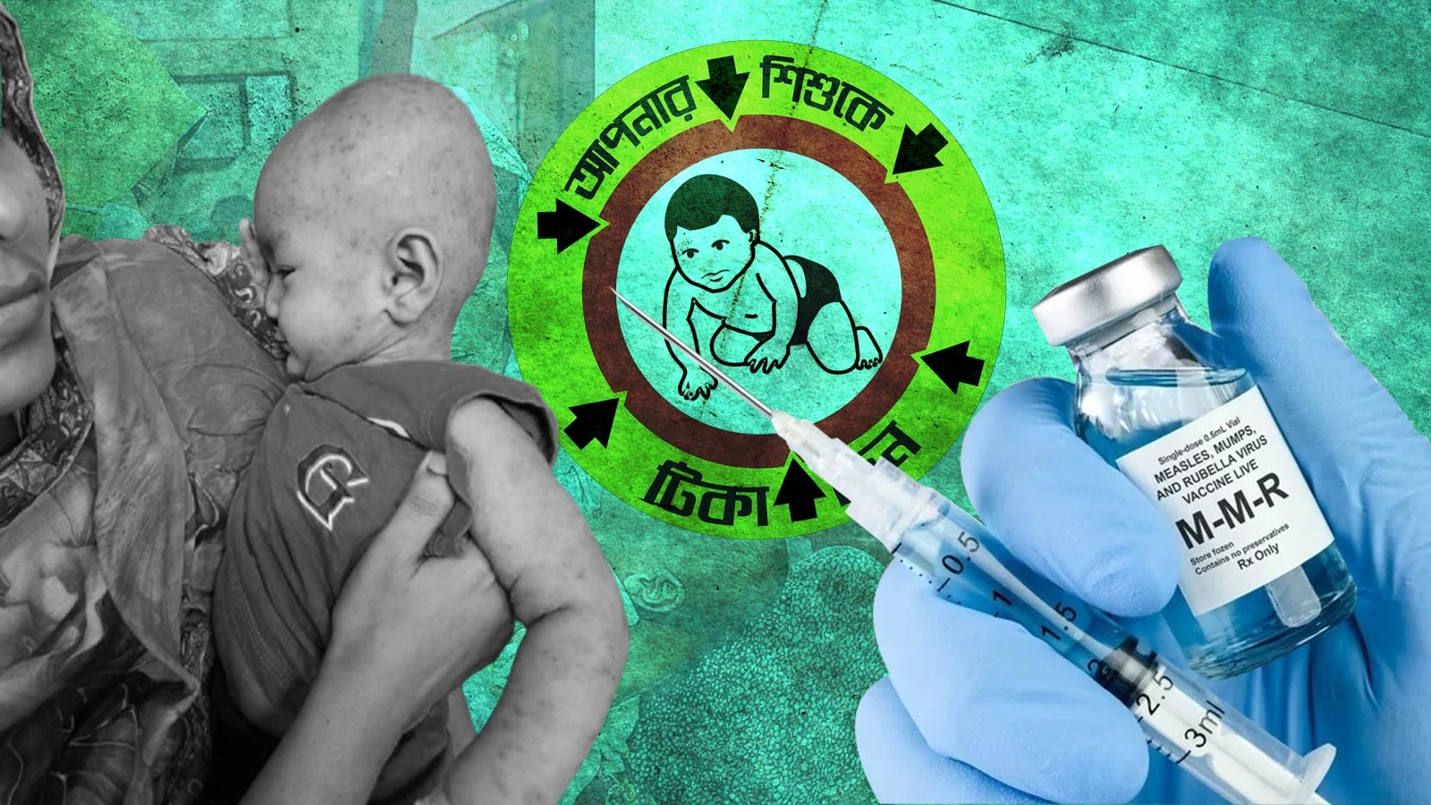 হাম প্রতিরোধে বিশেষ টিকাদান কর্মসূচি ৩ মে থেকে শুরু