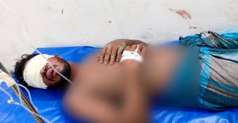 বোরহানউদ্দিনে যুবকের দুই চোখ উপড়ে ফেলার অভিযোগ